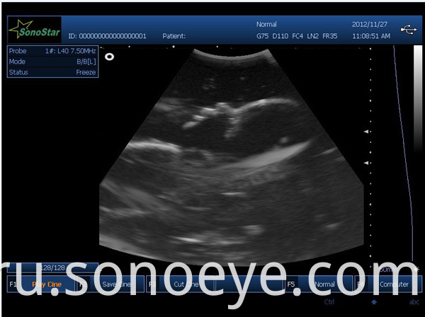 image for labtop ultrasound